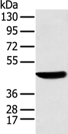 Rabbit Polyclonal Antibody to KRT18