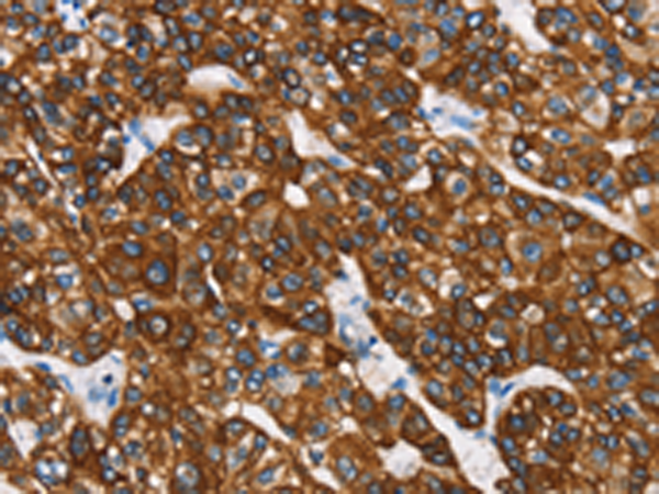Rabbit Polyclonal Antibody to KRT8