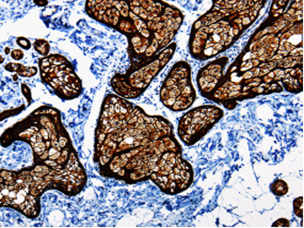 Rabbit Polyclonal Antibody to KRT17