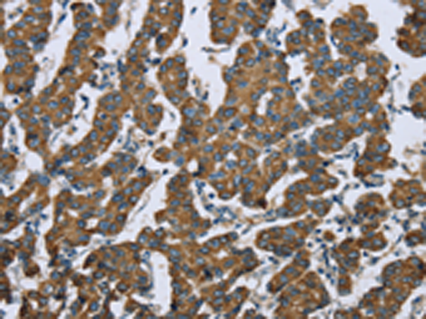 Rabbit Polyclonal Antibody to KRT5