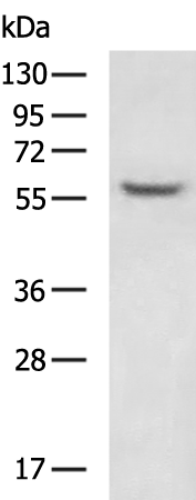 Rabbit Polyclonal Antibody to KRT6A