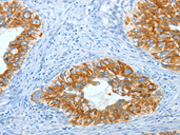 Rabbit Polyclonal Antibody to KRT40