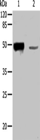 Rabbit Polyclonal Antibody to KRT31