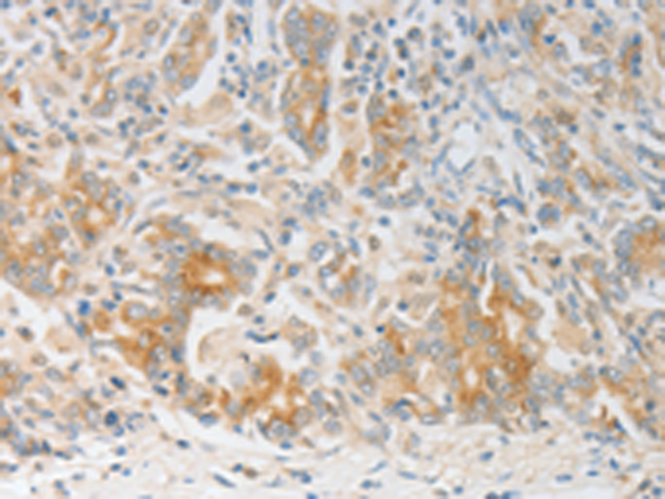 Rabbit Polyclonal Antibody to CALCR