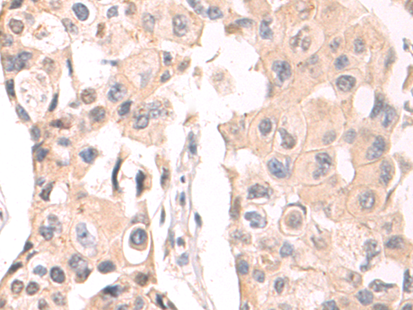 Rabbit Polyclonal Antibody to COL1A2