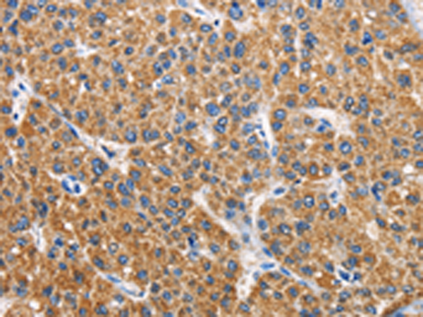 Rabbit Polyclonal Antibody to APLNR