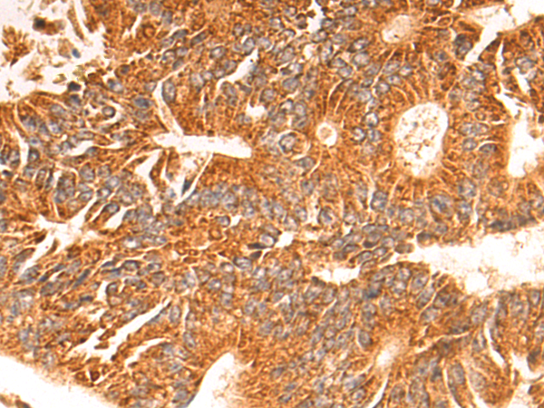 Rabbit Polyclonal Antibody to MUC15