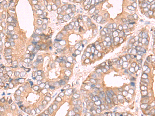 Rabbit Polyclonal Antibody to FTL