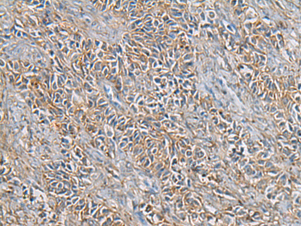 Rabbit Polyclonal Antibody to FTH1