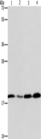 Rabbit Polyclonal Antibody to ARF6