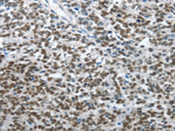 Rabbit Polyclonal Antibody to ARL2