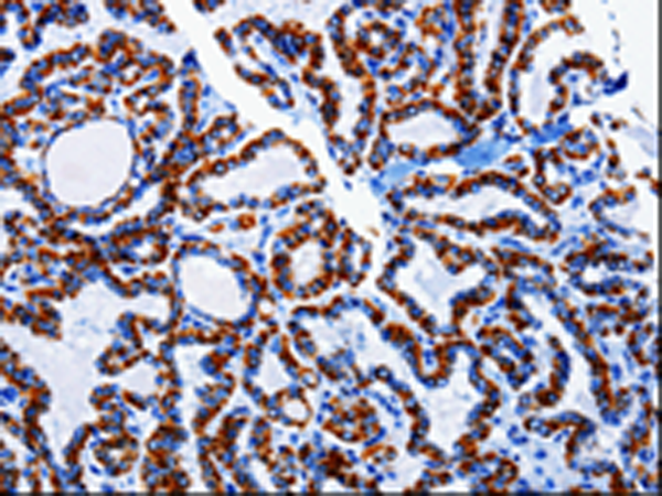 Rabbit Polyclonal Antibody to ARL6