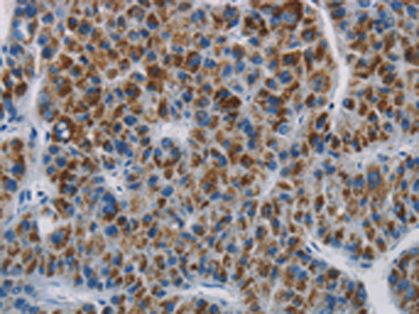 Rabbit Polyclonal Antibody to SAR1B
