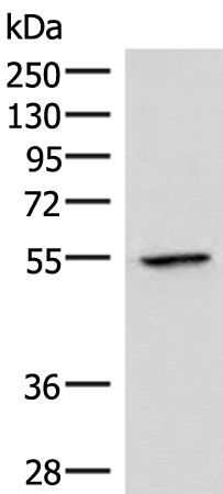Rabbit Polyclonal Antibody to VIM