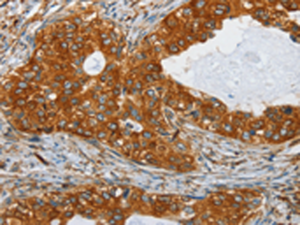 Rabbit Polyclonal Antibody to SEPTIN9