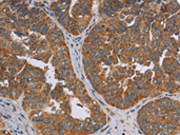 Rabbit Polyclonal Antibody to ADAMTS15