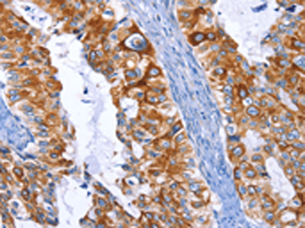 Rabbit Polyclonal Antibody to ARRB1