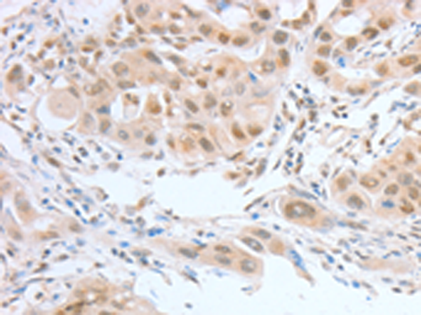 Rabbit Polyclonal Antibody to ATF2