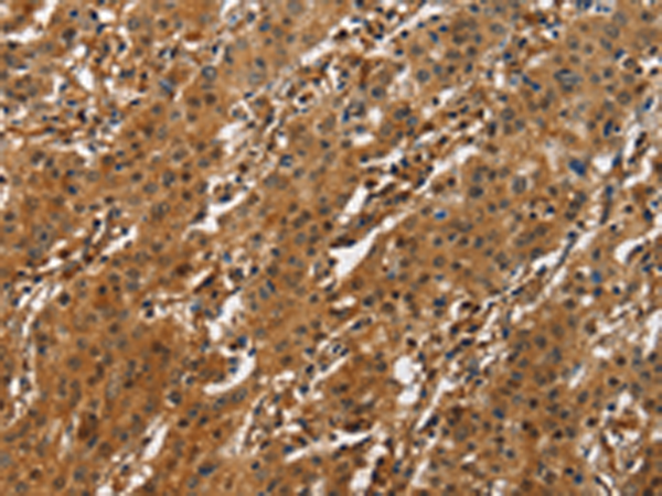 Rabbit Polyclonal Antibody to ATF4