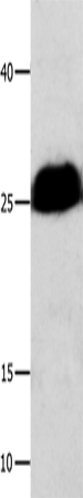 Rabbit Polyclonal Antibody to BCL2L1