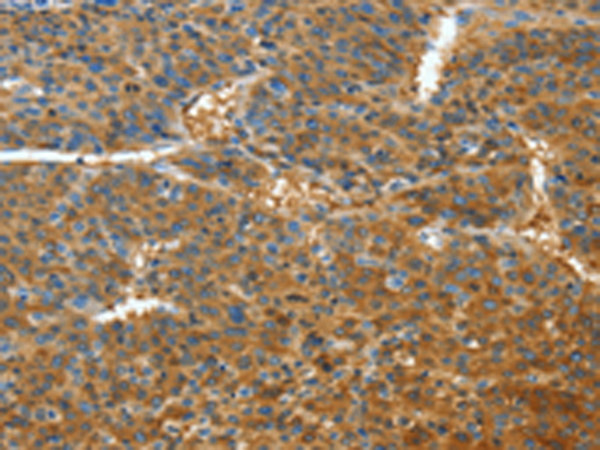 Rabbit Polyclonal Antibody to TNFSF13B