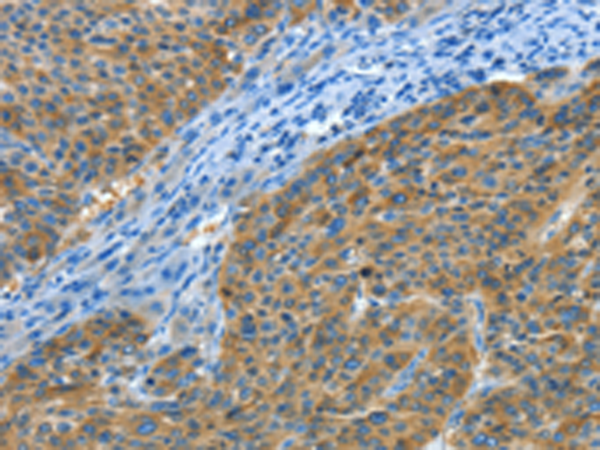 Rabbit Polyclonal Antibody to BIN1