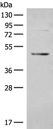 Rabbit Polyclonal Antibody to BMP3