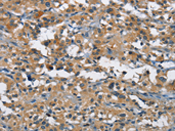 Rabbit Polyclonal Antibody to BMPR1B