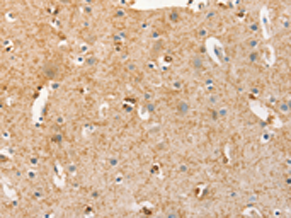 Rabbit Polyclonal Antibody to BRCA1