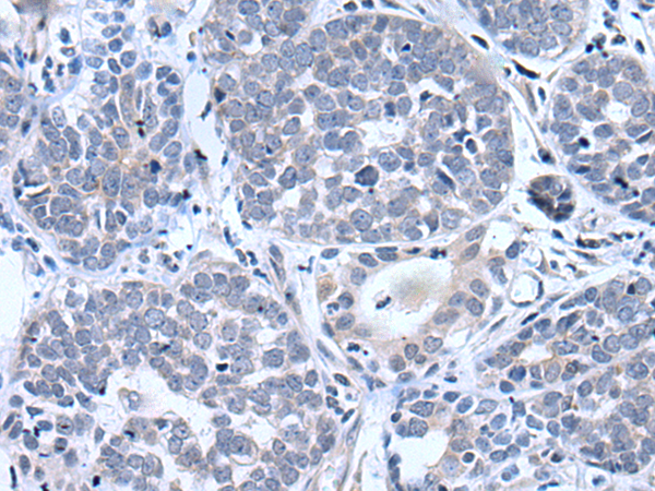 Rabbit Polyclonal Antibody to BTG4