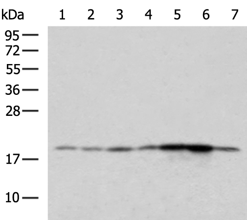 Rabbit Polyclonal Antibody to BTG2