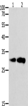 Rabbit Polyclonal Antibody to CAPNS1
