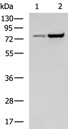 Rabbit Polyclonal Antibody to CAPN5