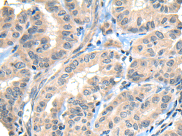 Rabbit Polyclonal Antibody to CNN1