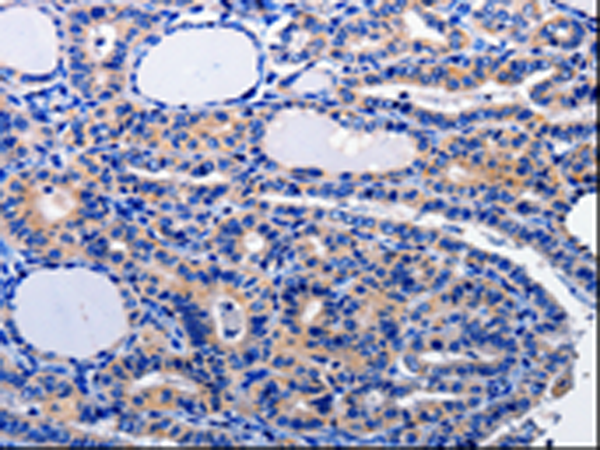 Rabbit Polyclonal Antibody to CAMK2B