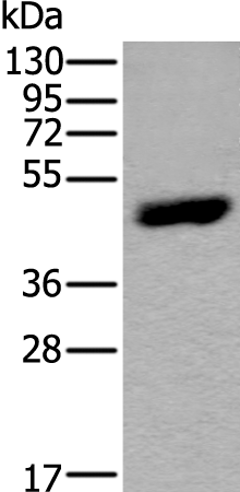 Rabbit Polyclonal Antibody to CA9