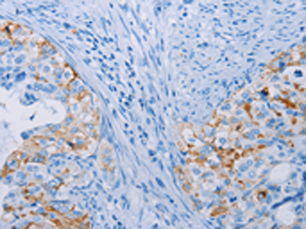 Rabbit Polyclonal Antibody to CA10