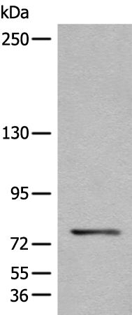 Rabbit Polyclonal Antibody to CTNNAL1