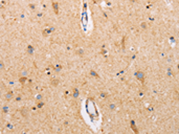 Rabbit Polyclonal Antibody to CTNNA1