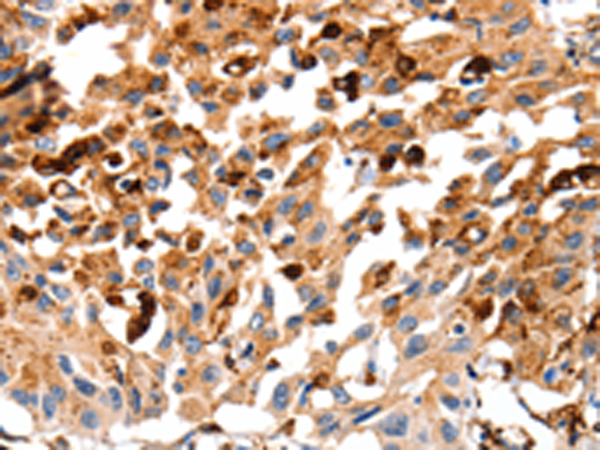 Rabbit Polyclonal Antibody to CTSB