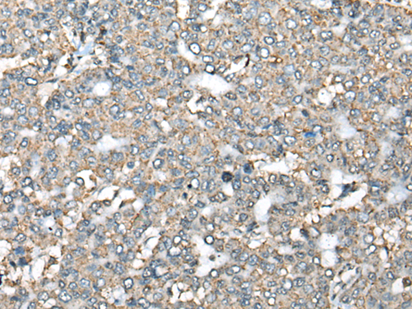 Rabbit Polyclonal Antibody to CTSD