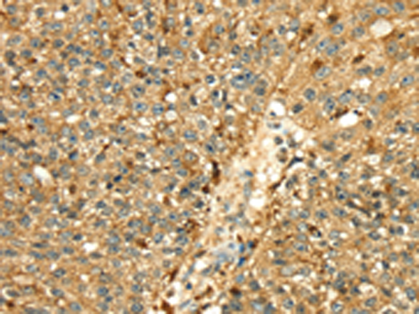 Rabbit Polyclonal Antibody to CTSH