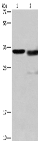 Rabbit Polyclonal Antibody to CTSL