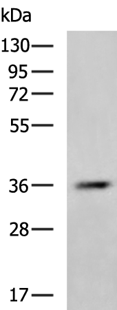 Rabbit Polyclonal Antibody to CTSZ