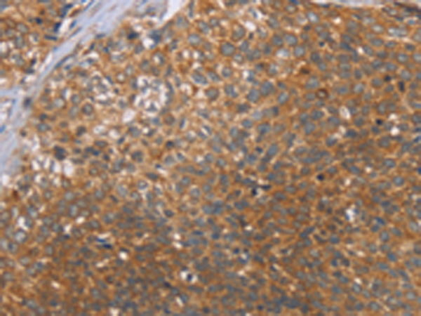 Rabbit Polyclonal Antibody to CCL21