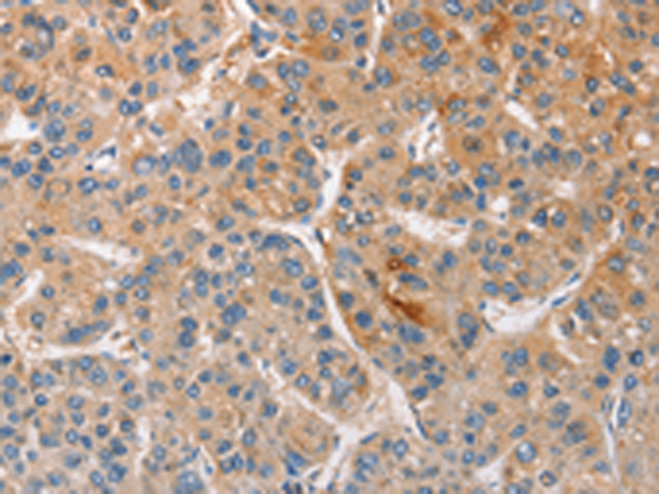 Rabbit Polyclonal Antibody to CCL4