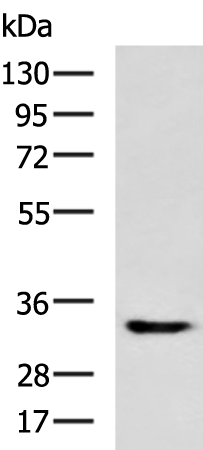 Rabbit Polyclonal Antibody to CLEC7A