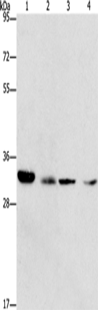 Rabbit Polyclonal Antibody to CDK2