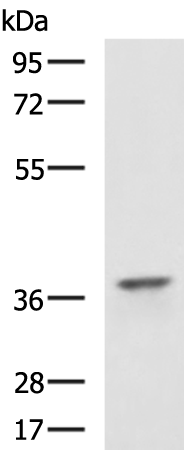 Rabbit Polyclonal Antibody to CDK6