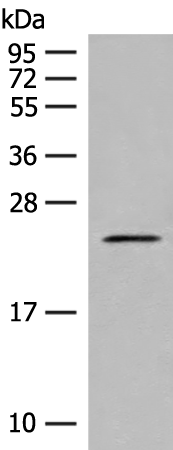 Rabbit Polyclonal Antibody to CDKN1A